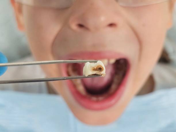 Best Emergency Dentist for Knocked-Out Tooth in Keyport, NJ